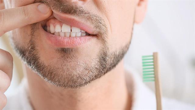 Ουλίτιδα και περιοδοντίτιδα: Ποιες είναι οι διαφορές τους;