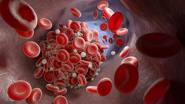 Χαμηλά αιμοπετάλια: Συνήθη αίτια θρομβοπενίας