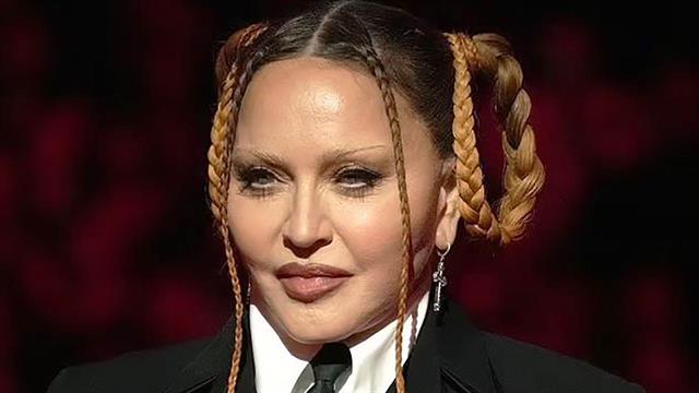 Πλαστικοί χειρουργοί εξηγούν τη νέα εικόνα της Μαντόνα