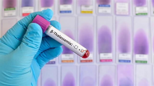 Η Διεθνής Ομοσπονδία Θαλασσαιμίας σε διαβούλευση με τον ΟΗΕ για την παραβίαση των δικαιωμάτων ασθενών με θαλασσαιμία στην υγεία