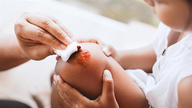 Τροφές που βοηθούν στην επούλωση πληγών