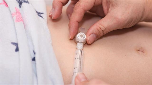 ECDC: Κρούσματα αλλαντίασης από ενέσεις μπότοξ Α στην Τουρκία - Πού έχουν εντοπιστεί