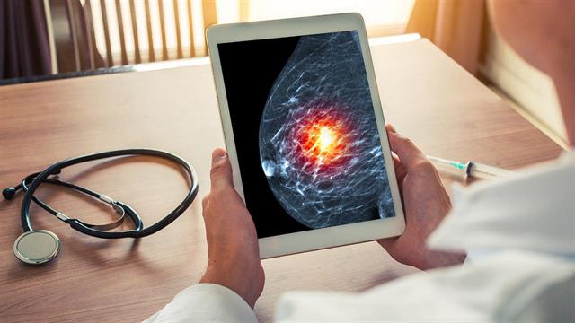 Ακτινοδιαγνώστης μαστού: Διευρυμένα τα κριτήρια εμπειρίας