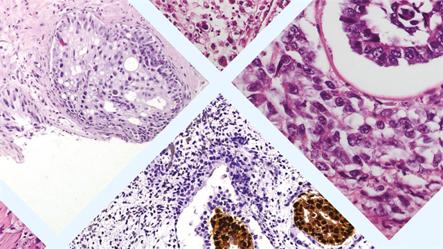 31 Μαρτίου ξεκινά το Ευρωπαϊκό Μετεκπαιδευτικό Σεμινάριο Παθολογικής Ανατομικής και Ογκολογίας στα Ιωάννινα