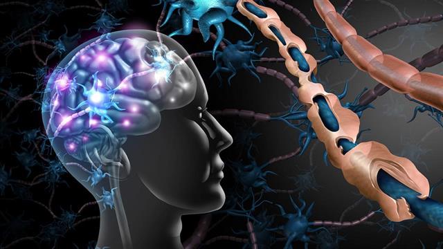 Νέα θεραπευτική επιλογή για την πολλαπλή σκλήρυνση