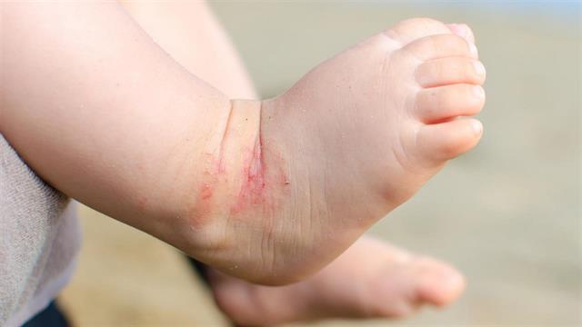 Συνέδριο ’’Εαρινές Ημέρες Παιδοδερματολογίας’’ από την ΕΔΑΕ