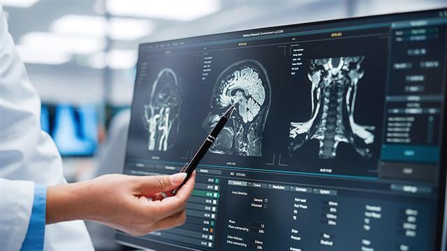 Νέος στόχος για τη θεραπεία των εγκεφαλικών μεταστάσεων