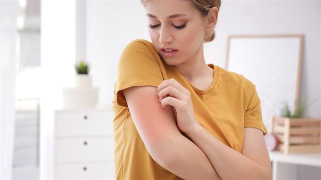 Εξανθήματα λόγω στρες: Όσα πρέπει να ξέρετε