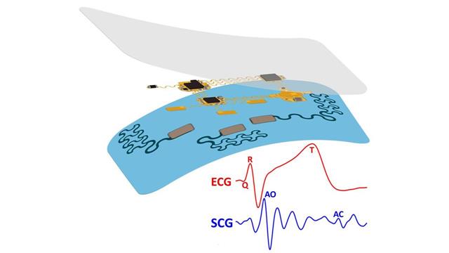 e-tattoo στον θώρακα για την παρακολούθηση της καρδιάς