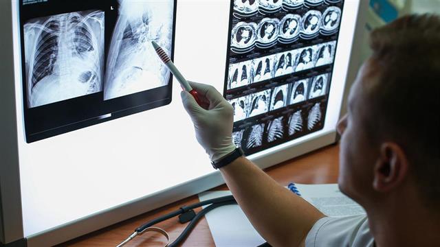 Χωρίς ακτινολόγους στις γενικές εφημερίες το νοσοκομείο Άρτας