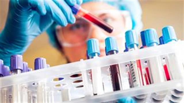 Χρόνια κόπωση: Ποιες εξετάσεις πρέπει να είναι οπωσδήποτε φυσιολογικές