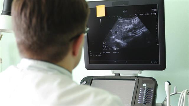 Λιπώδης νόσος ήπατος και κίνδυνος καρκίνου - Σχέση με παχυσαρκία και διαβήτη [ελληνική μελέτη]