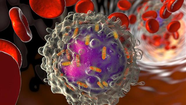 Λεμφοκυτταρική λευχαιμία: ελπιδοφόρα νέα μέθοδος θεραπείας [μελέτη]