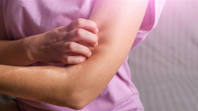 Η  βασική φροντίδα της νευροδερματίτιδας