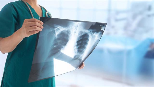 CoViD-19 και καρκίνος πνεύμονα - Σύγκριση έκβασης καρκινοπαθών και μη