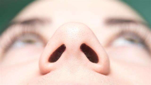 Παραρρινοκολπίτιδα με ή χωρίς ρινικούς πολύποδες