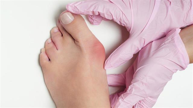 Πώς θεραπεύεται το ‘’κότσι’’;