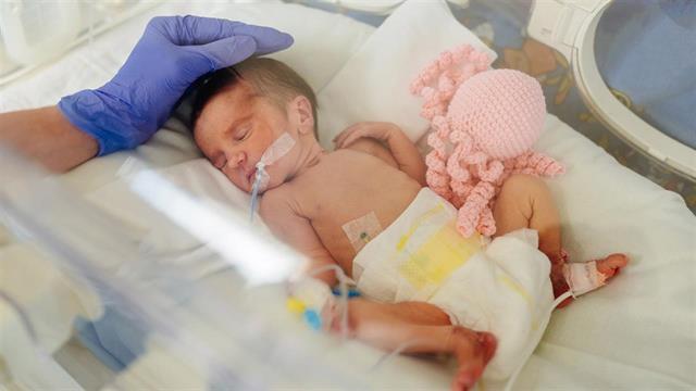 Προωρότητα: Φροντίζοντας το νεογνό και τους γονείς