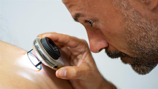 Μελάνωμα: Πώς η τεχνητή νοημοσύνη βελτίωσε θεαματικά τη διάγνωση