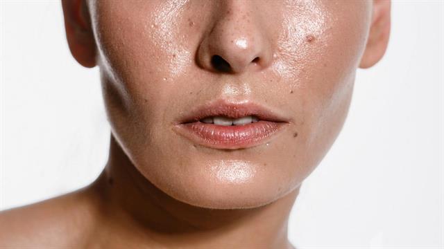 Καλοκαίρι: Μυστικά για να αντιμετωπίσετε τη λιπαρή επιδερμίδα