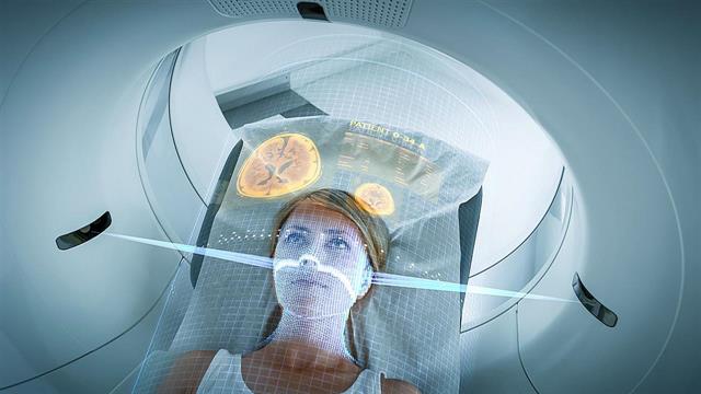 Αλγόριθμος προβλέπει την εξέλιξη του εγκεφάλου σε διάστημα έξι ετών [μελέτη]