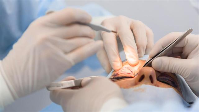 Βλεφαροπλαστική επέμβαση: Ποιος μπορεί να επωφεληθεί από αυτή;