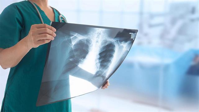 Πού λειτουργεί το πρώτο ιατρείο προσυμπτωματικού ελέγχου για τον καρκίνο του πνεύμονα