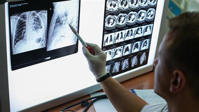 Η καλή φυσική κατάσταση στους νέους μειώνει τον κινδυνο για 9 τύπους καρκίνου στην ενήλικη ζωή [μελέτη]