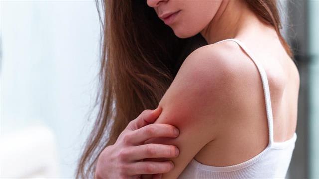 Πως επηρεάζει το δέρμα ο καπνός από τις φωτιές στο δάσος