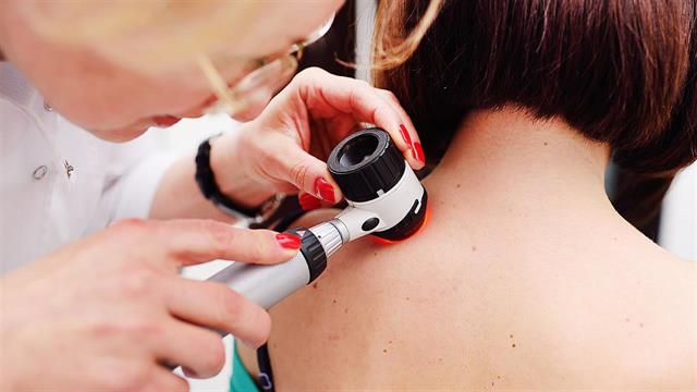 BMS: Έγκριση για το nivolumab ως επικουρική θεραπεία σε μελάνωμα σταδίου IIB ή IIC που έχει εξαιρεθεί πλήρως χειρουργικά