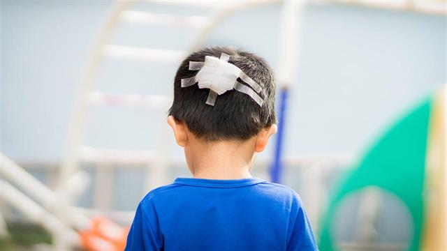 Επιβεβλημένη η 24ωρη παρακολούθηση μετά από πτώση