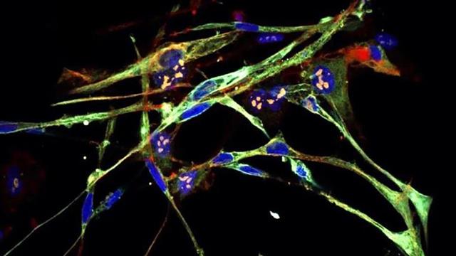 Επιστήμονες μετέτρεψαν καρκινικά κύτταρα σε υγιή μυϊκό ιστό με τεχνολογία γονιδιακής επεξεργασίας CRISPR