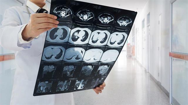 Οι ανδρικοί νεφροί είναι πιο ευάλωτοι από τους γυναικείους