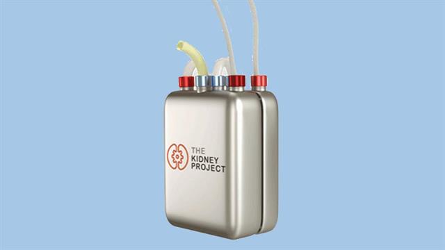 Βιοτεχνητός νεφρός μπορεί να αλλάξει το μέλλον των μεταμοσχεύσεων [μελέτη]