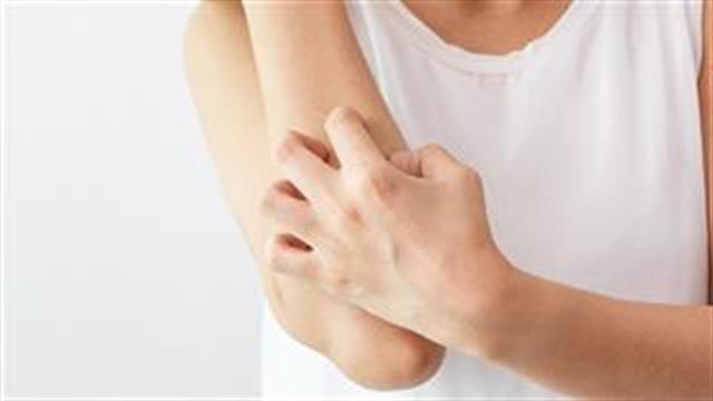 Δράσεις ενημέρωσης και ευαισθητοποίησης για την ατοπική δερματίτιδα