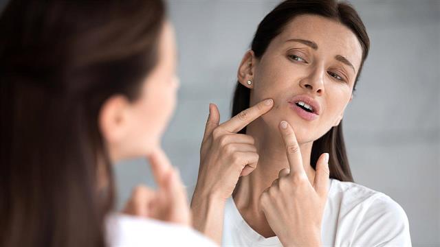 Θεραπεία ακμής με αντιβιοτικό που χορηγείται με μικροσκοπικούς θύλακες [μελέτη]