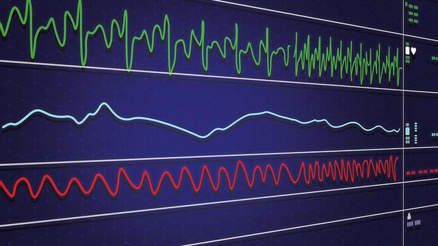 Στα €2,3 δισ. ο τζίρος εταιρειών ιατροτεχνολογικών προϊόντων στην Ελλάδα