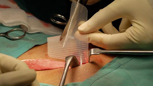 Κήλες κοιλιακού τοιχώματος: Σύγχρονες μέθοδοι αντιμετώπισής τους