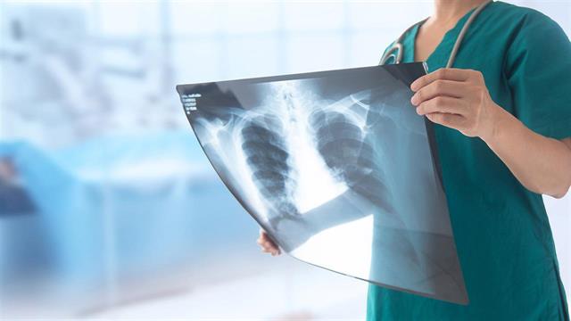 Ανάγκη για στήριξη της Πολιτείας στην εφαρμογή των κατευθυντήριων οδηγιών για την πρόληψη του καρκίνου του πνεύμονα