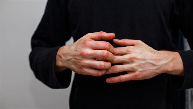 Ψωρίαση: Η πρώιμη θεραπεία  δεν επηρεάζει τη  διάρκεια της νόσου [μελέτη]