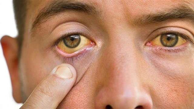 Πώς ένα smartphone μπορεί να εντοπίσει την κίρρωση ήπατος