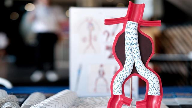 Aνεύρυσμα κοιλιακής αορτής: Παράγοντες κινδύνου  και θεραπεία