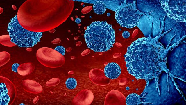 EMA: Ενέκρινε νέα μονοθεραπεία για το υποτροπιάζον, ανθεκτικό πολλαπλό μυέλωμα