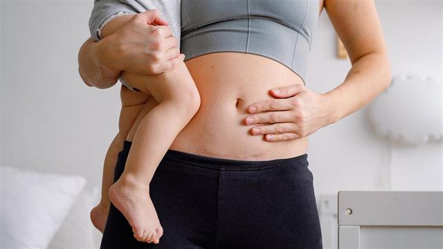 Πόσο αυξήθηκαν οι καισαρικές τομές στην Ελλάδα και γιατί [μελέτη]