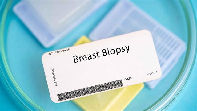 Η αξία της προεγχειρητικής διάγνωσης στον καρκίνο του μαστού