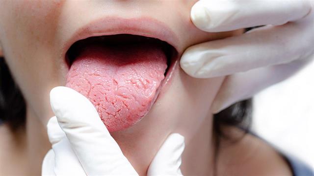 Τι λέει η γλώσσα μας για την υγεία μας;