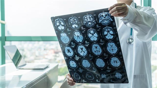 Σχέση μεταξύ αξονικών τομογραφιών σε νέους και αυξημένου κινδύνου για καρκίνο [μελέτη]