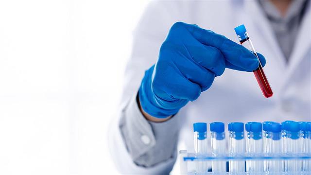 Τσάμπα πάνω από το 40% των διαγνωστικών εξετάσεων