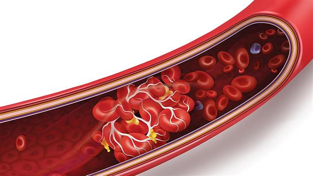 6ο Σχολείο της Ελληνικής Φλεβολογικής Εταιρείας