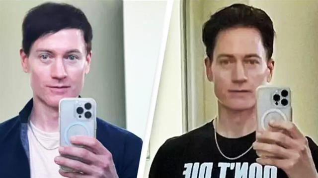 Βιοχάκερ δίνει 1,8 εκατομμύριο ευρώ τον χρόνο για να αναστρέψει τη γήρανση